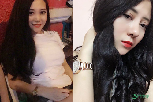 Nữ DJ 21 tuổi thành công nhờ phẫu thuật thẩm mỹ - 1