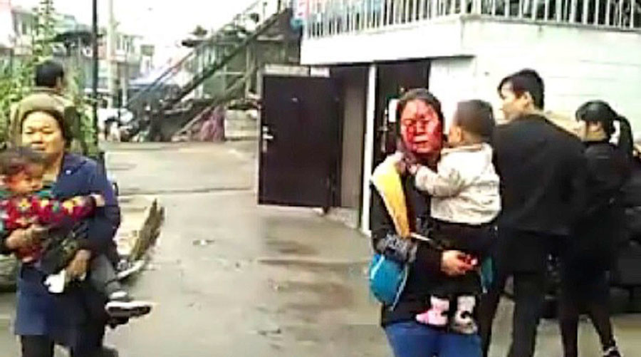 TQ: Nổ kinh hoàng khiến 7 người chết, 95 người bị thương - 3