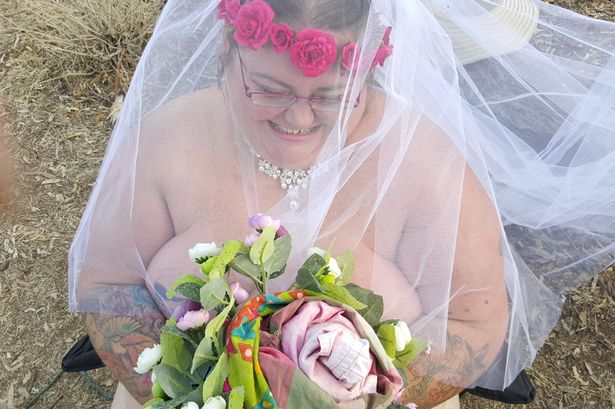Sau 31 ngày hôn mê, cô gái tỉnh dậy làm đám cưới khỏa thân - 1