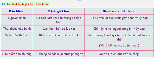 Cách phân biệt vết zona thần kinh, "giời leo" và kiến 3 khoang cắn - 3