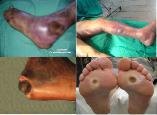 Liên tục khát nước - Hãy nghĩ ngay đến căn bệnh này - 1