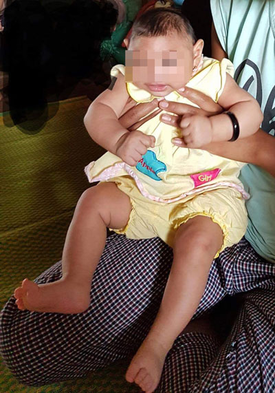 Bé gái 4 tháng tuổi ở Đắk Lắc bị dị tật do virus Zika - 1