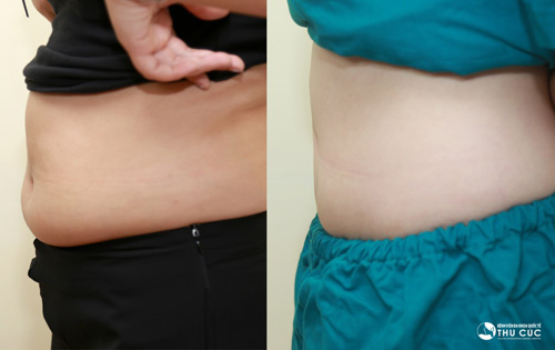 “Sốt” với detox thanh lọc cơ thể: Giảm 3-5 cm vòng eo chỉ sau 1 lần - 6
