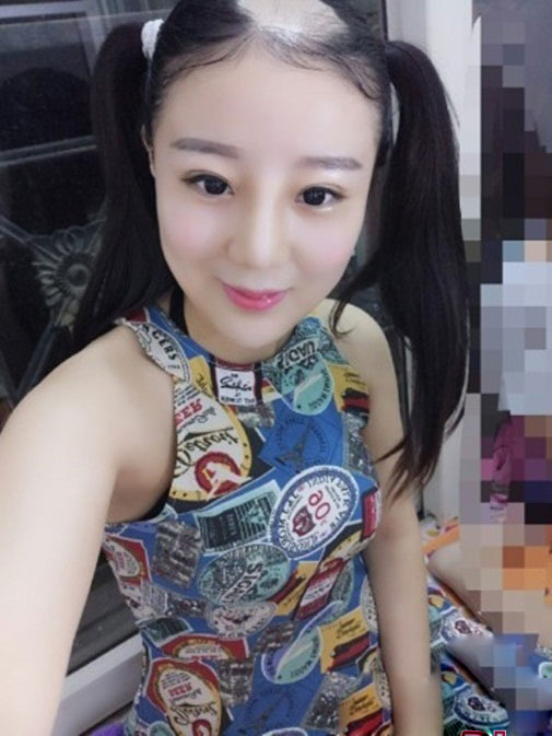 Gặp lại cô gái bay cả da đầu vì ăn ngô bằng máy khoan - 3