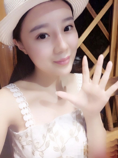 Gặp lại cô gái bay cả da đầu vì ăn ngô bằng máy khoan - 7