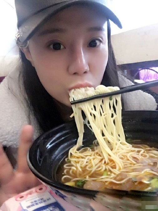 Gặp lại cô gái bay cả da đầu vì ăn ngô bằng máy khoan - 8