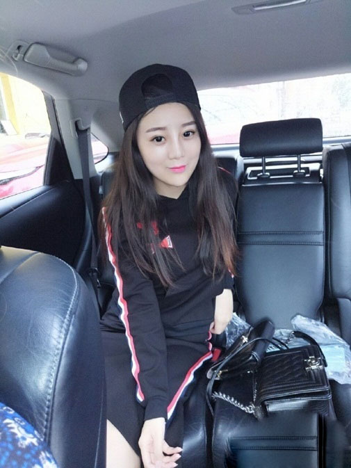 Gặp lại cô gái bay cả da đầu vì ăn ngô bằng máy khoan - 9