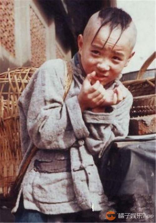 29 tuổi, cuối cùng "cậu bé Tam Mao" đã mọc tóc - 3