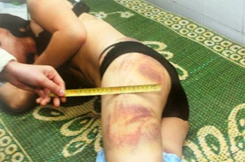 Phụ nữ bị đánh đập: Giữ “hình ảnh”để làm gì? - 1