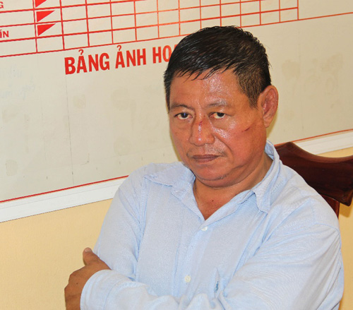 Đề nghị truy tố vụ Trung tá Campuchia bắn 2 người VN - 1