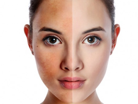 Bộ mỹ phẩm Dr.Perfect – 'khắc tinh' của da thâm nám - 1