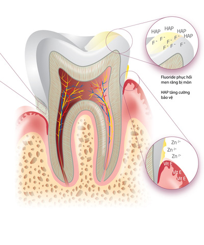 Thực hư chuyện tẩy trắng khiến răng ê buốt - 4