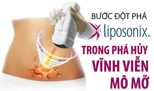 Nhận quà tặng trị giá lên tới 40 triệu đồng sau một lần giảm béo - 1