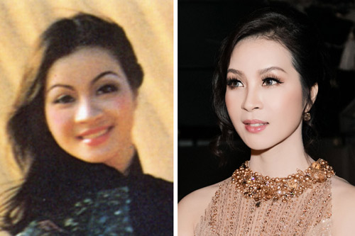 Trẻ hóa, xóa nhăn kì diệu- Đây là các công nghệ đang gây sốt - 4