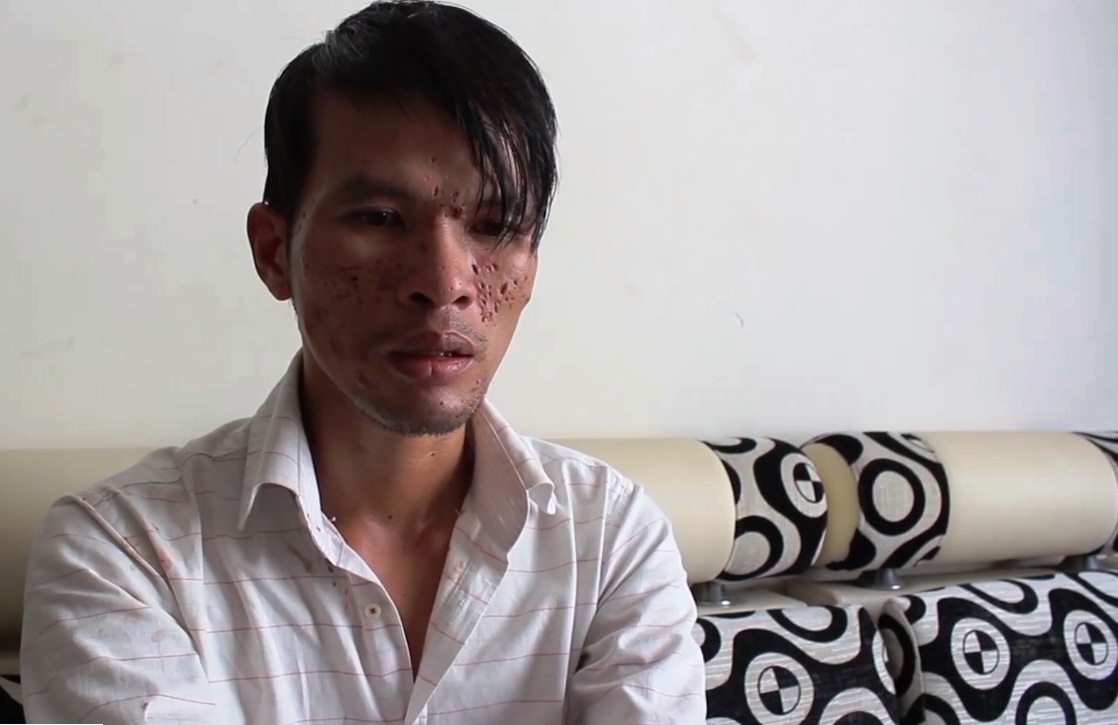 Nghi phạm hành hạ bé trai Campuchia từng quỳ gối xin được tha thứ - 1