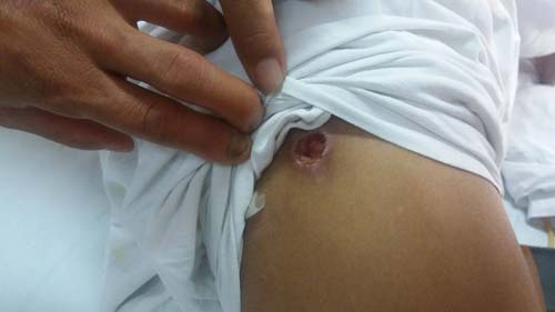 Vào rừng hái măng, người đàn ông bị gấu cào nát 2 mắt - 2