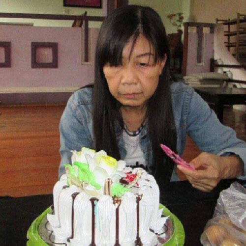 Sự thật về cô gái 21 tuổi với dung nhan bà lão 80 - 2