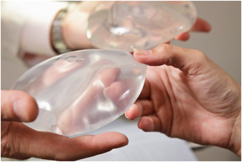 Hiểm họa khó lường khi nâng ngực túi nước biển - 2