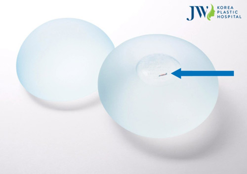 Hiểm họa khó lường khi nâng ngực túi nước biển - 4