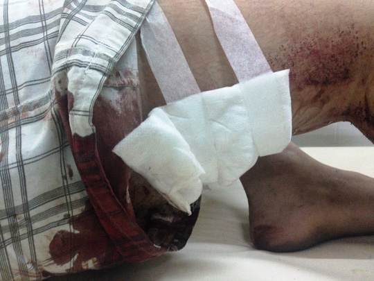 Kẻ khống chế, đâm người trong khu nhà trọ nói gì? - 3