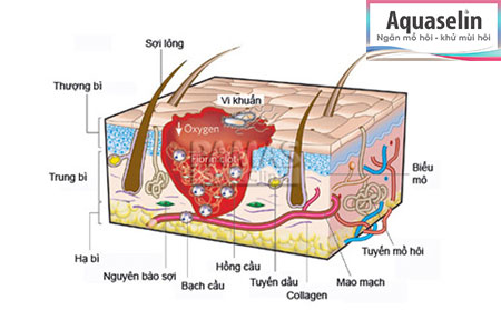 Biện pháp nhanh chóng và hữu hiệu khử mùi hôi nách - 2