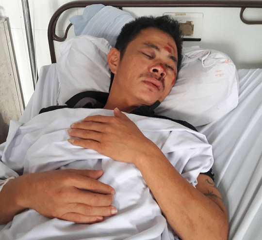 Chở khách tới quán karaoke, tài xế bị đánh vỡ hàm, dập mũi - 1