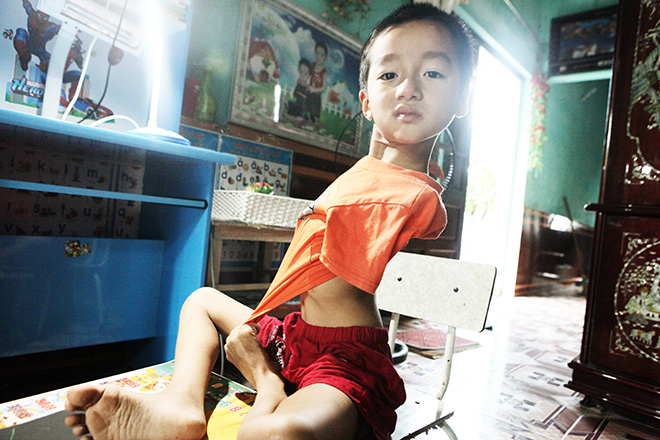 ​Cậu bé 7 tuổi đẹp như thiên thần không có tay từ trong bụng mẹ - 2