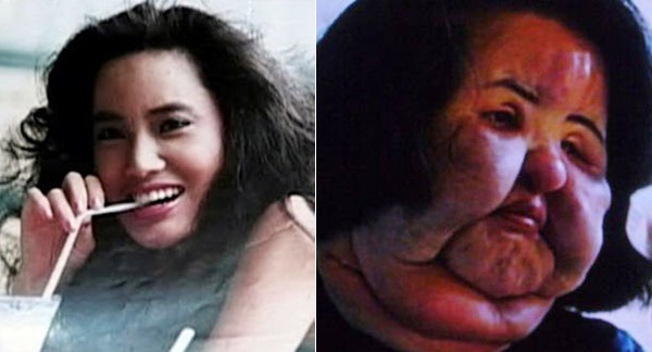 Showbiz Hàn: &#34;Đập mặt xây lại&#34; không phải lúc nào cũng như mơ - 3