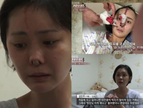 Showbiz Hàn: &#34;Đập mặt xây lại&#34; không phải lúc nào cũng như mơ - 2