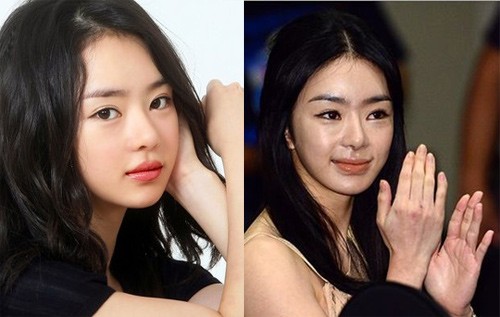 Showbiz Hàn: &#34;Đập mặt xây lại&#34; không phải lúc nào cũng như mơ - 4