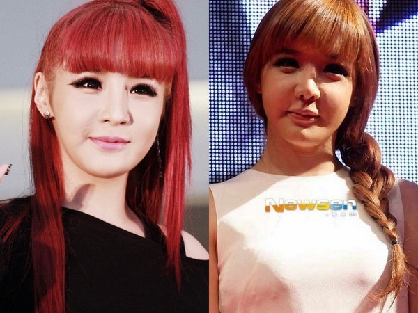 Showbiz Hàn: &#34;Đập mặt xây lại&#34; không phải lúc nào cũng như mơ - 5