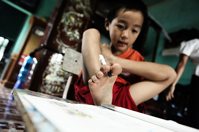 Ảnh - Clip: Đôi chân diệu kì của cậu bé 7 tuổi không tay - 6