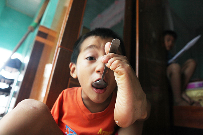 Ảnh - Clip: Đôi chân diệu kì của cậu bé 7 tuổi không tay - 12