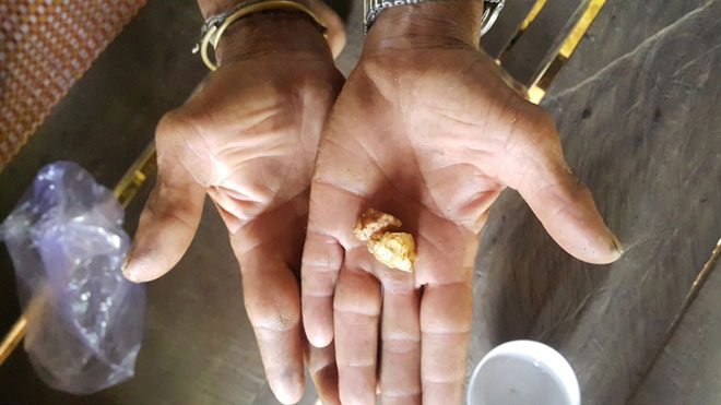 Vạch trần thủ đoạn lừa bịp của các lang băm - 4