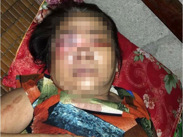 Mâu thuẫn khi chơi bài, nam thanh niên đánh hỏng mắt người "cùng xới" - 1