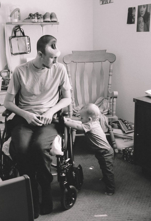 Tình yêu người vợ dành cho chồng chỉ có nửa hộp sọ - 3