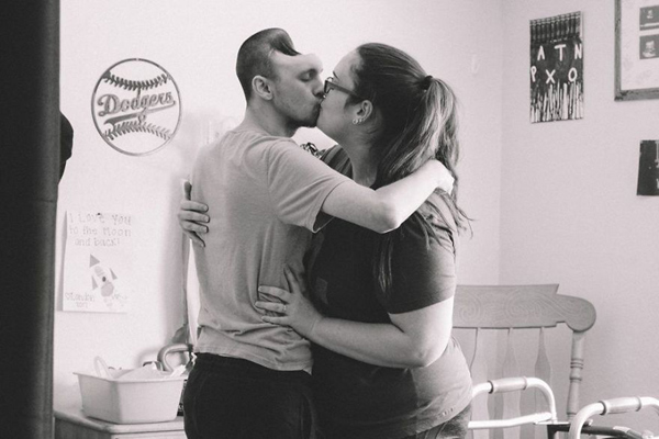 Tình yêu người vợ dành cho chồng chỉ có nửa hộp sọ - 4