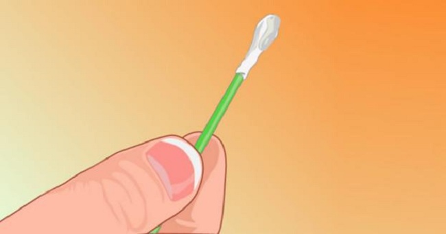 Màu sắc ráy tai tiết lộ chính xác vấn đề sức khỏe của bạn - 2