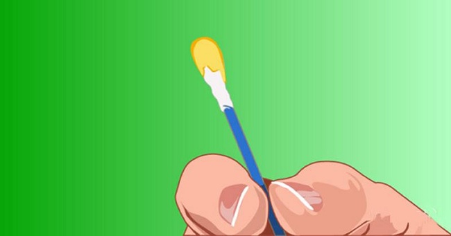 Màu sắc ráy tai tiết lộ chính xác vấn đề sức khỏe của bạn - 3