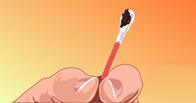 Màu sắc ráy tai tiết lộ chính xác vấn đề sức khỏe của bạn - 4