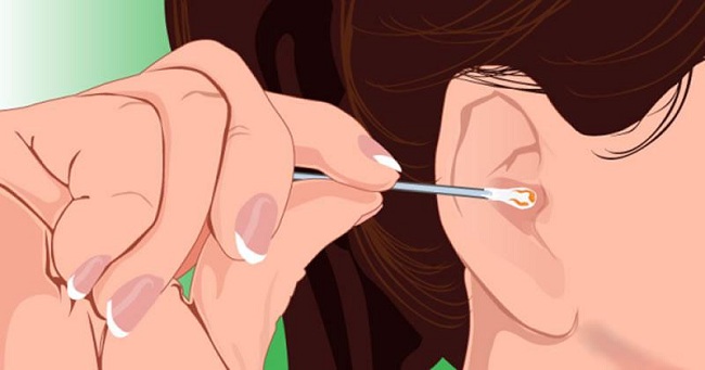 Màu sắc ráy tai tiết lộ chính xác vấn đề sức khỏe của bạn - 7