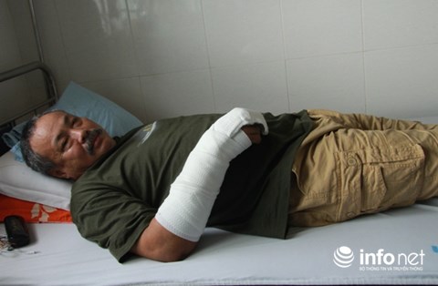 Bị phát hiện, tên trộm bịt mặt đâm chủ nhà 7 nhát dao - 2