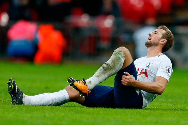 Đại chiến MU – Tottenham: Harry Kane chấn thương, Mourinho có kế &#34;độc&#34; - 1