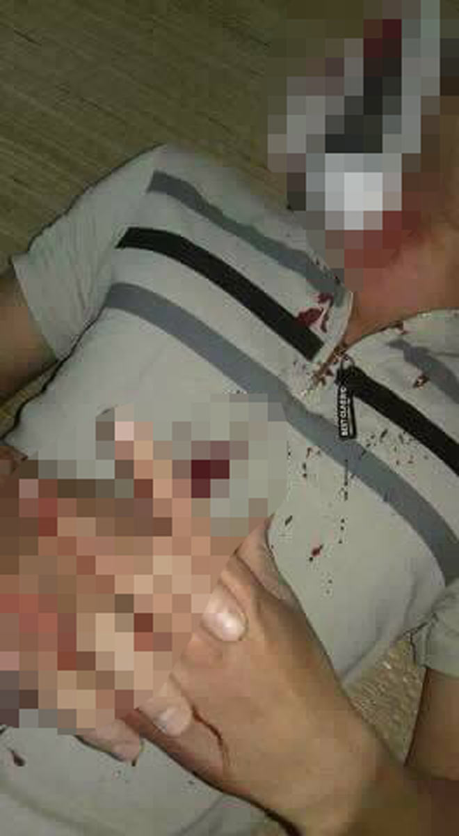 Xác minh thông tin điện thoại phát nổ khiến thanh niên rách cổ - 2