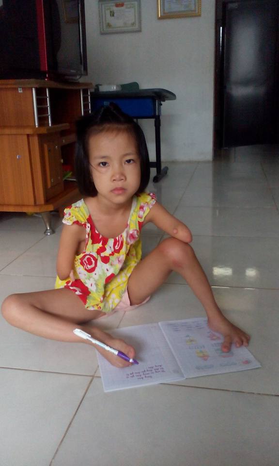 Cô bé không tay, dùng chân viết giấc mơ đến trường - 1