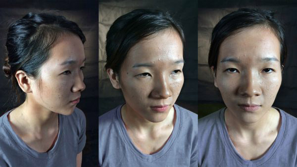 Cô gái “mắt lươn” gây sốc với diện mạo mới quá hoàn hảo! - 1