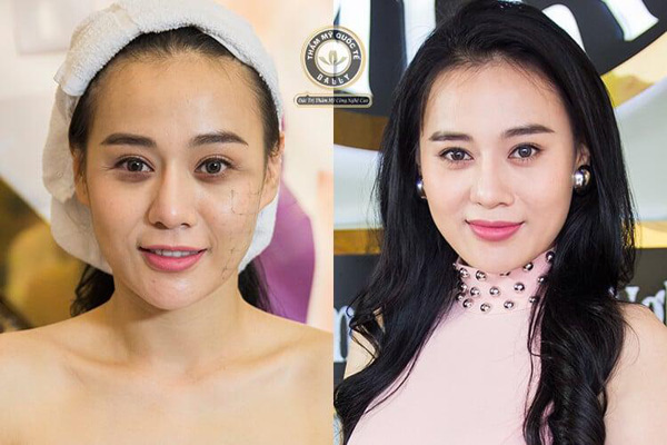 Bây giờ, làm đẹp tự nhiên bằng công nghệ cao mới là "mốt"! - 3