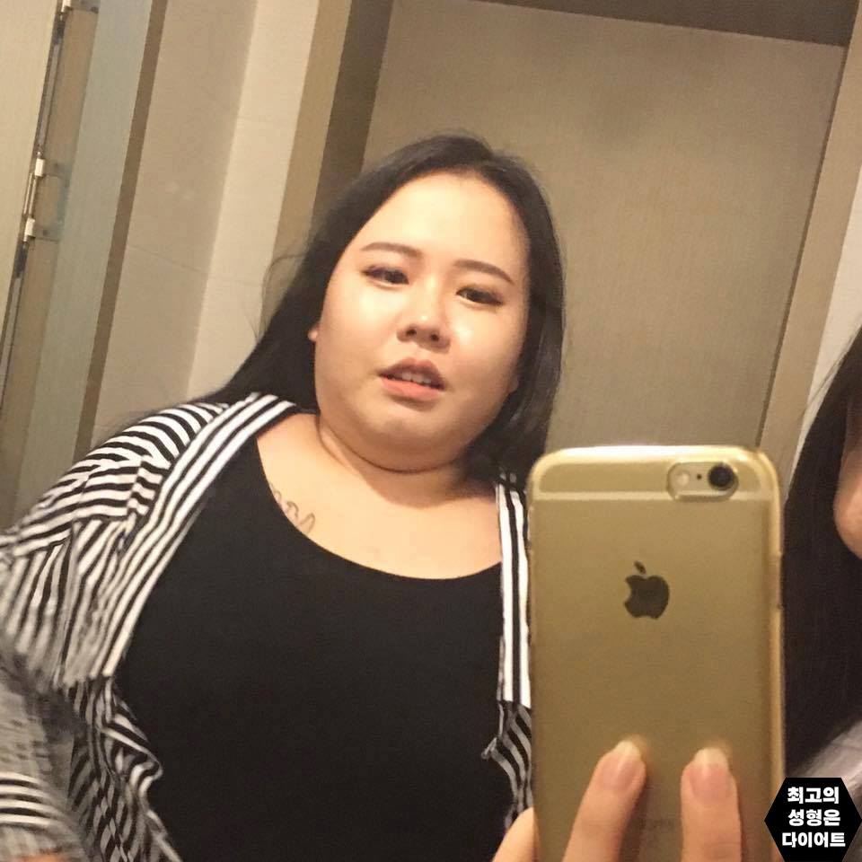 Cô gái xinh đẹp Hàn Quốc tung ảnh quá khứ béo múp, xấu xí - 1