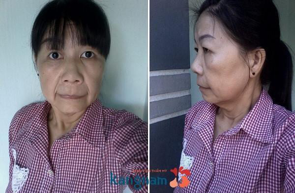 Cô gái Việt mắc bệnh “lão hóa nhi” cực hiếm trên thế giới - 2