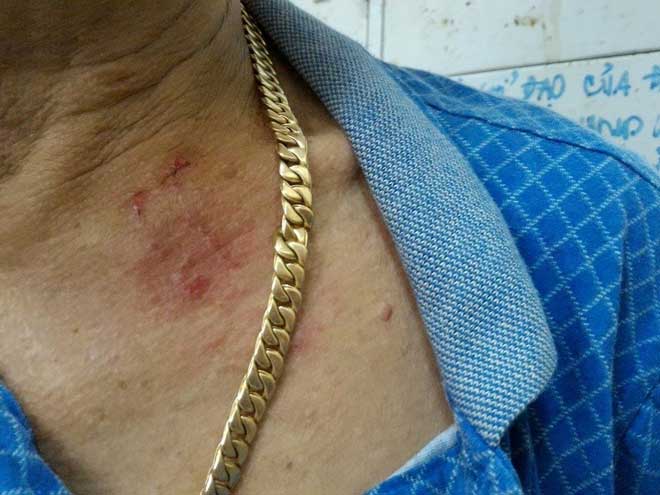 Giật sợi dây chuyền 2,5 lượng, 2 thanh niên té nhào - 2